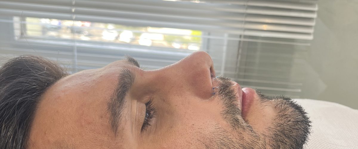 نمونه عمل دکتر اسدالله پور